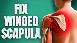 Schouderblad dat uitsteekt? Zo los je het op