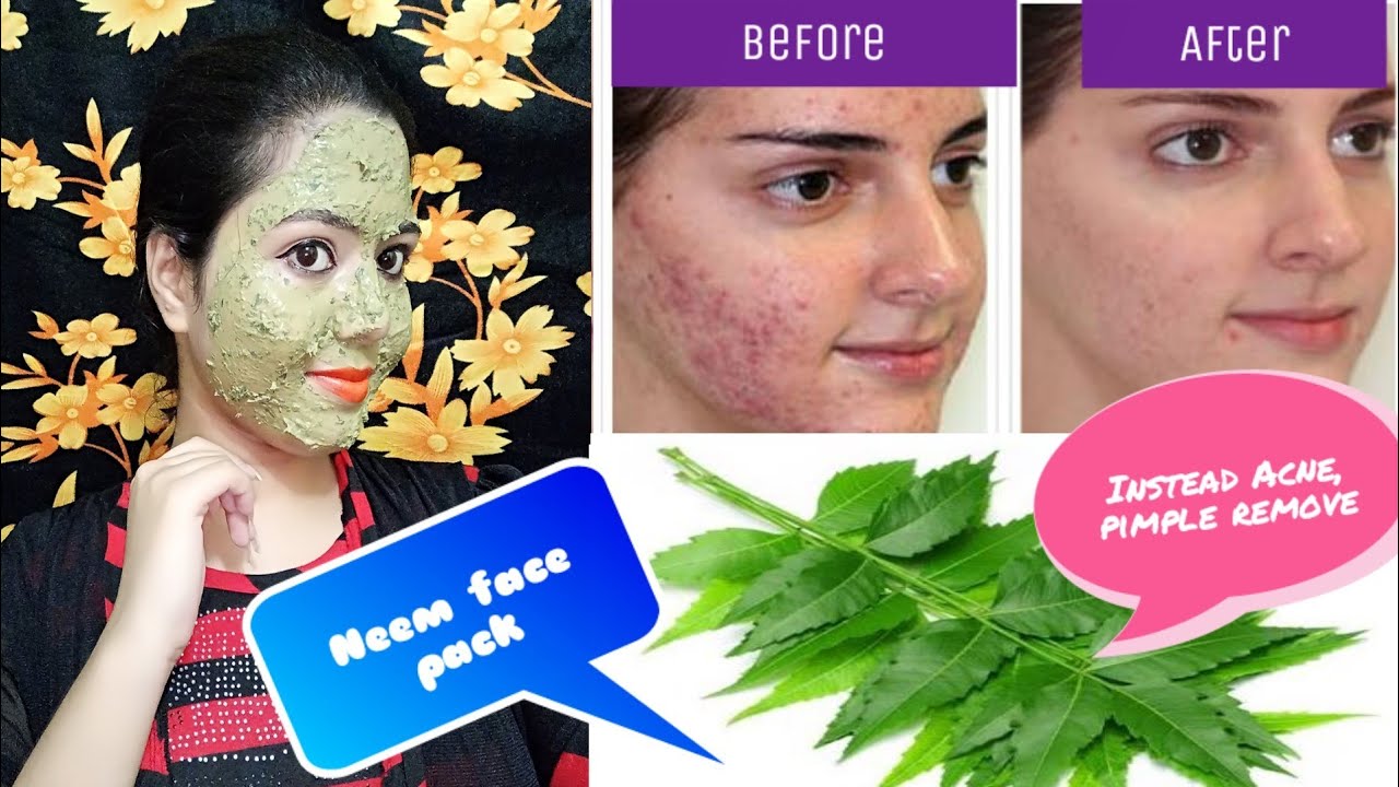 Summer Special Neem face pack ••• Instead remove acne / rashes / pimple