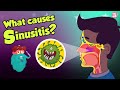 What causes sinusitis  sinus infection  dr binocs show  peekaboo kidz