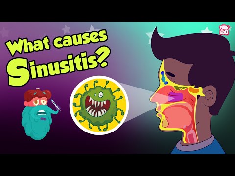 Video: Hoe manifesteer sinusitis by volwassenes en kinders