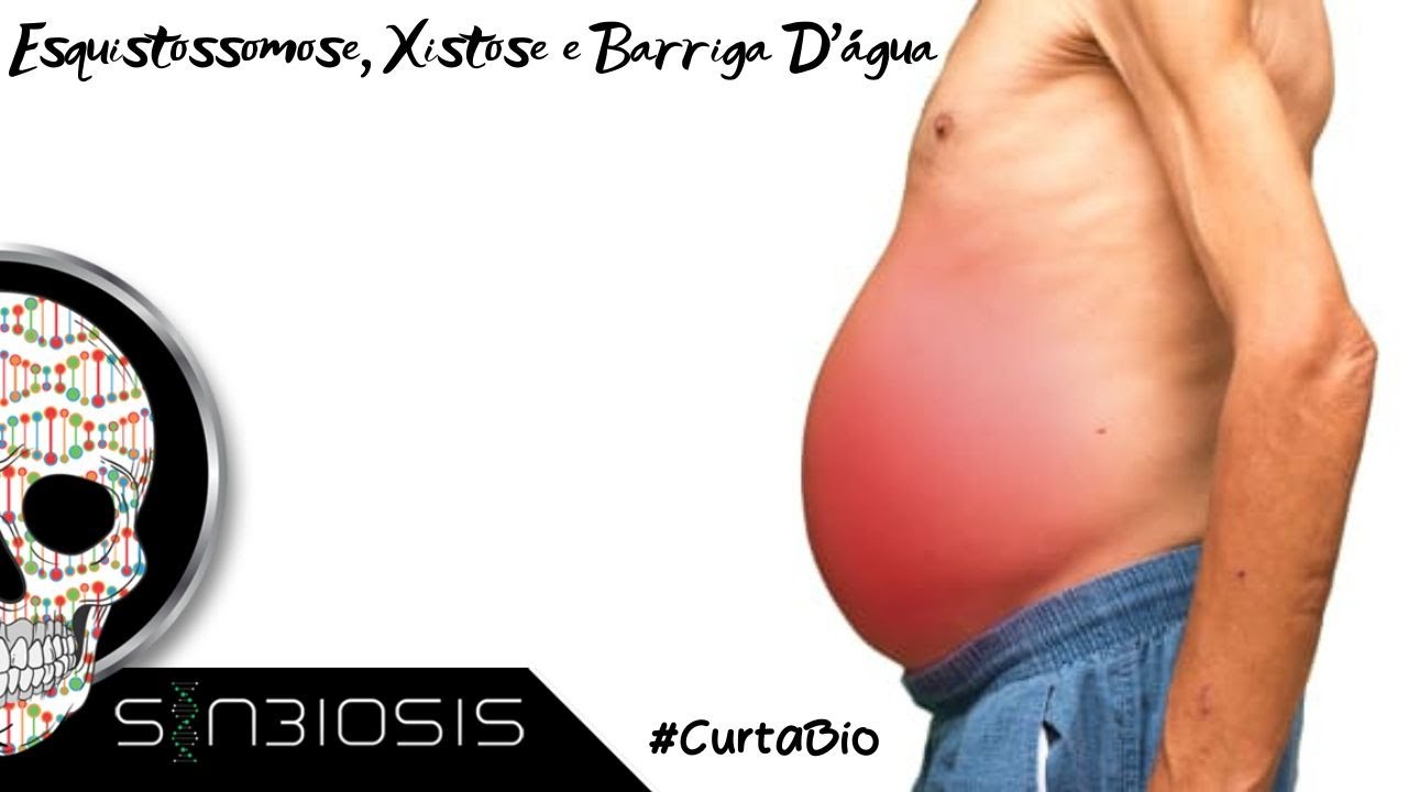 O Que é Barriga D'água - NAZAEDU