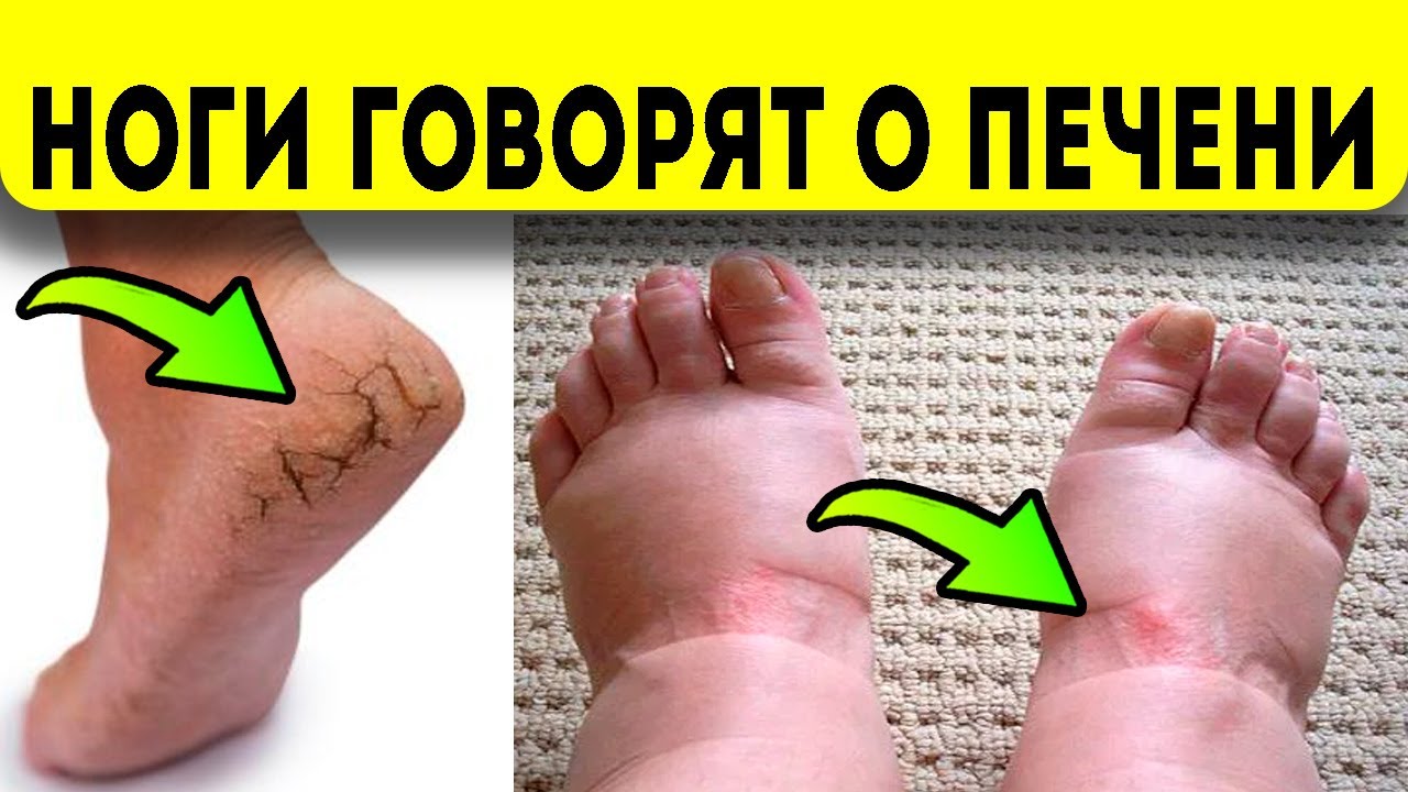 Нива холодно ногам