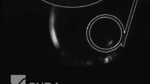 Ultrasound Test of Tube 2