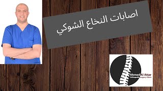 اصابات النخاع الشوكي وطريقة التفكير للدكتور احمد العطار
