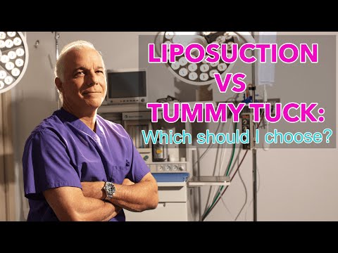 Liposuction vs Tummy Tuck: Which should I choose?