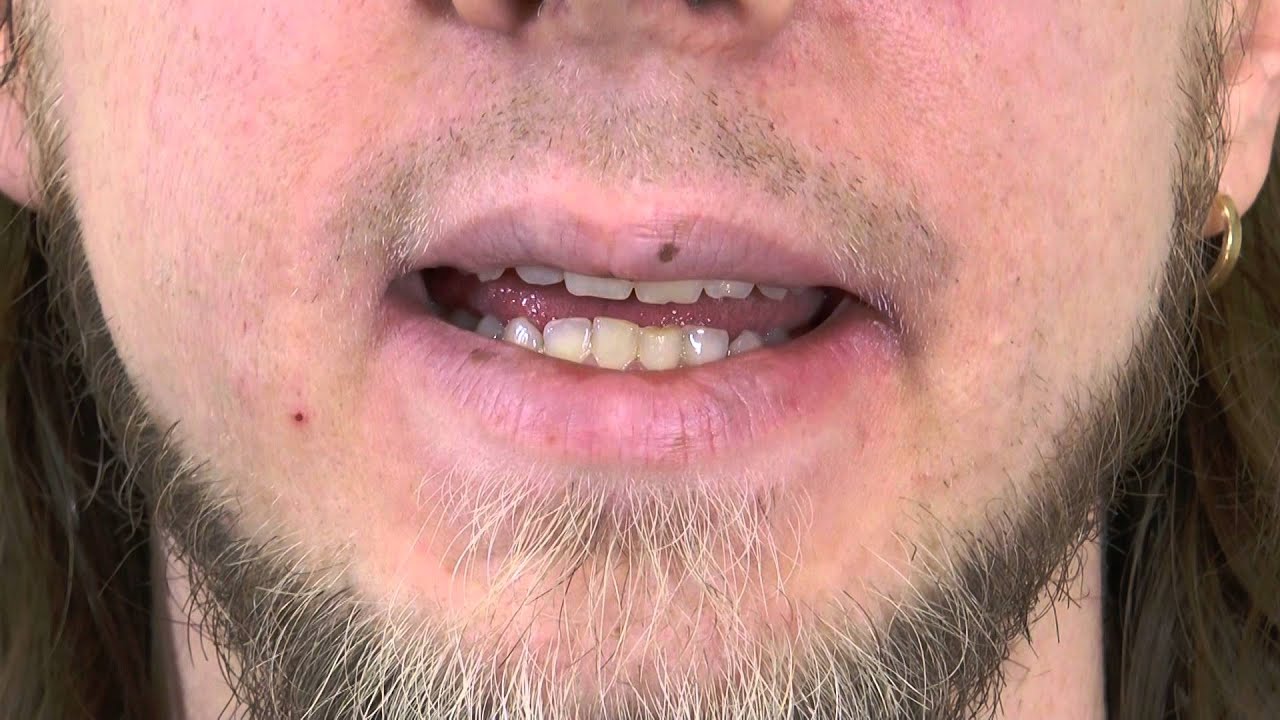 Uttal – I / Vuxnas lärande Karlskoga Degerfors