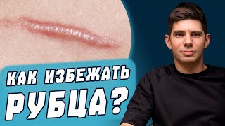 Келоидные Рубцы после Подтяжки Груди правда и миф?