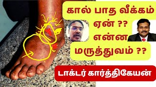 foot swelling treatment in tamil | dr karthikeyan-diabetes | கால் வீக்கம் எதனால் ஏற்படுகிறது screenshot 3