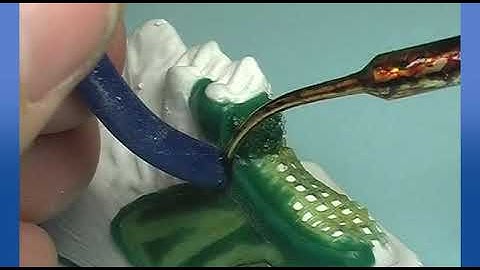 Rhein83 OT Vertical ENG