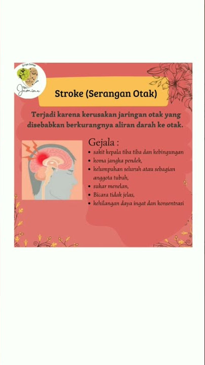 akupunktur stroke #fyp#fy #fypシ #shorts #short #shortvideo #shortsfeed #shortsyoutube #shortvideos