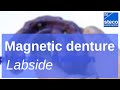 magnetic dental prostheses: impression and dental lab