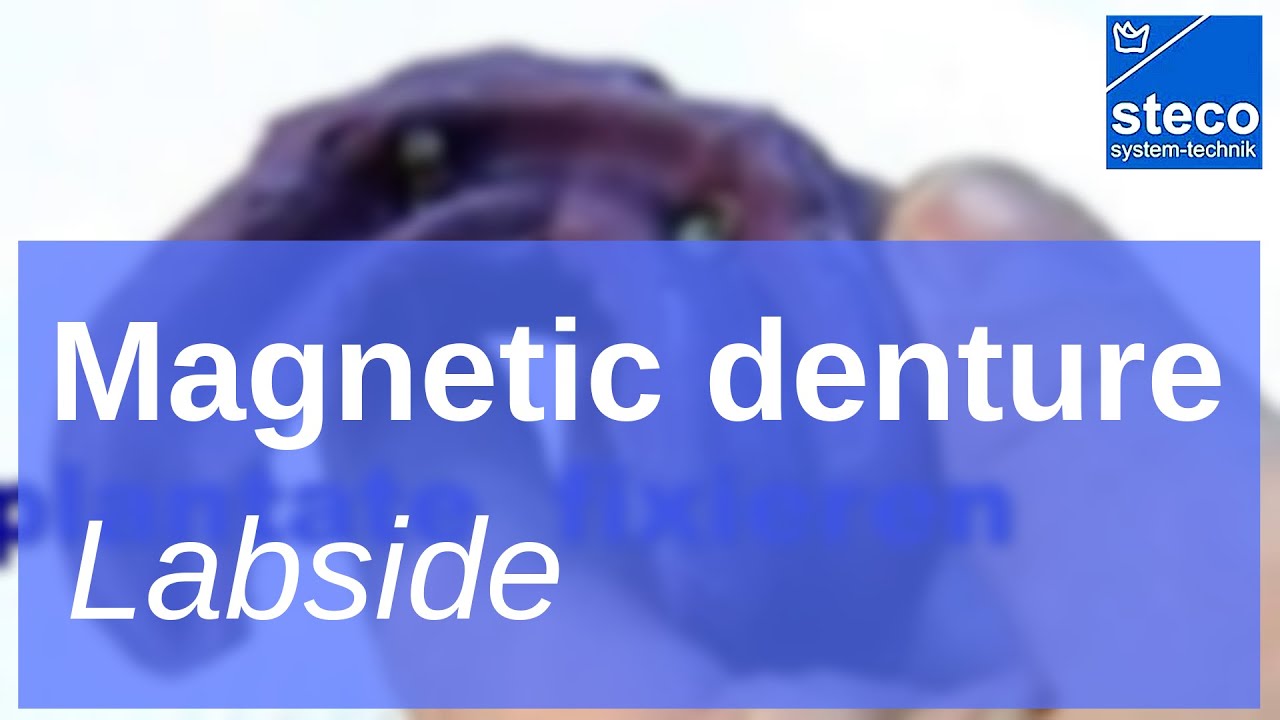 dental prostheses impression and dental lab YouTube