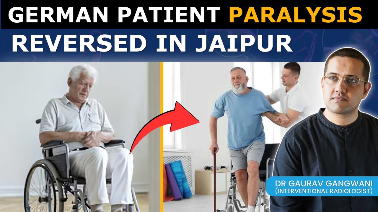 From Paralysis to Freedom: 24-Hour Paralysis Reversal Using Mechanical ...