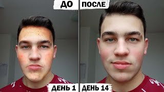 Уход За Лицом Вот Почему Ето Работает