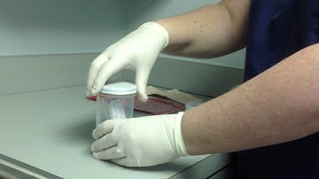 Proper Sputum collection and submission