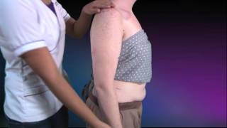Skin folds