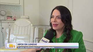 Tratamento da Pele com Mpox, Dra. Luciane Bravi Hübner, Rede Globo, TV Tem, Tem Notícias 20/09/2024