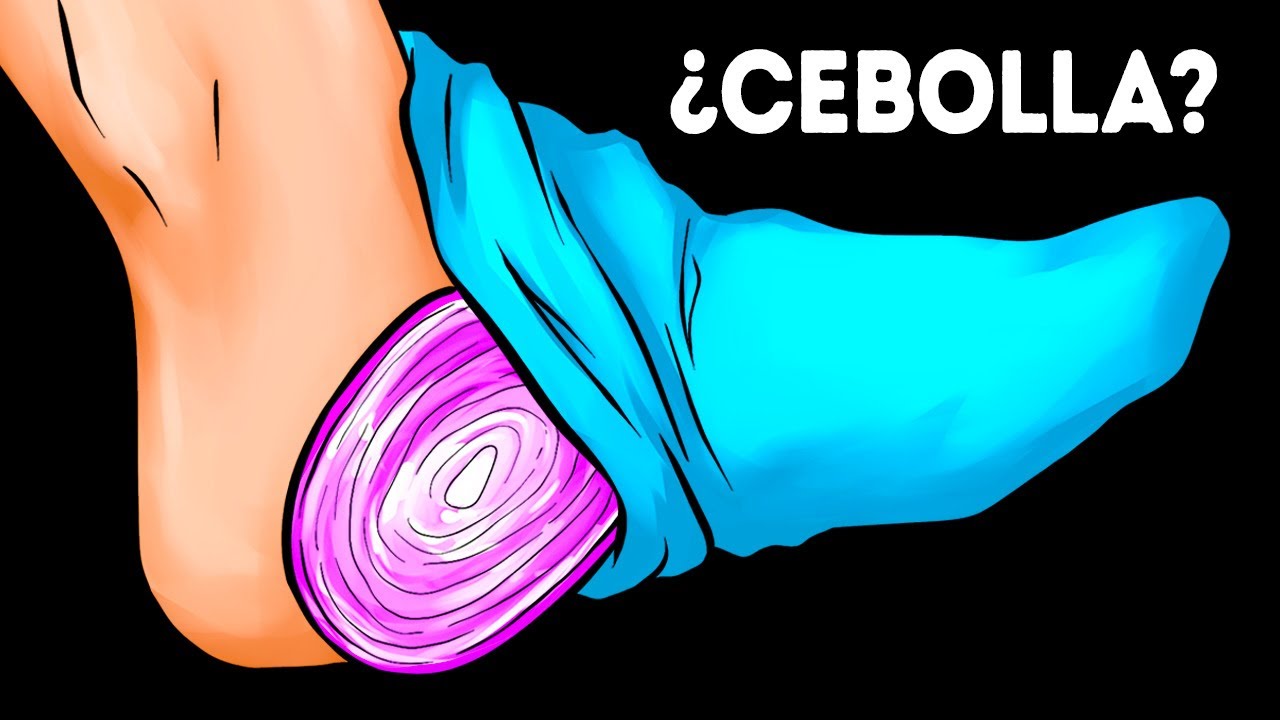 Mete una cebolla en tu calcet�n antes de dormir, �despierta y ver�s!