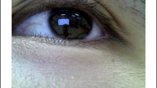 Model-based iris tracking