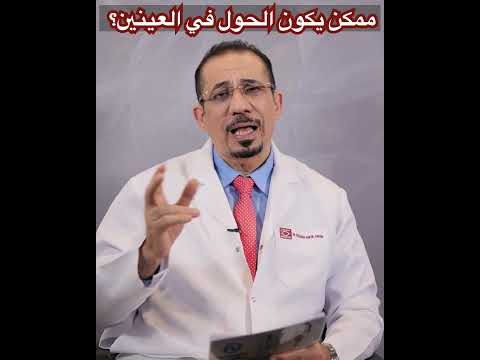 ٢٠ ممكن يكون الحول في العينين