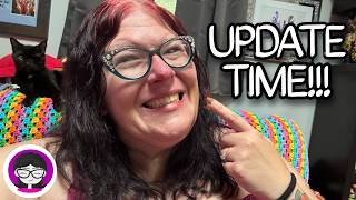 One Week with My New Teeth!!!