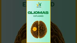 Unlocking the Genetics of Glioma—Now Simplified with AI