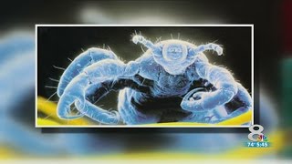 Heres What You Need To Know About Treating Super Lice