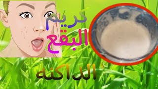 كريم البقع الداكنه//كريم العنايه بالبشرة//كريم ازالة البقع الداكنه