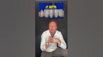 How to fix Black Triangles with the Bioclear Method