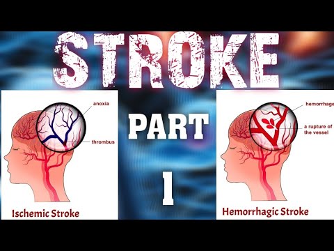 STROKE || PART-1 || ISCHEMIC STROKE || HEMORRHAGE STROKE || TRANSIENT ISCHEMIC STROKE (TIA)