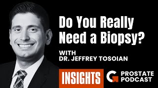 How Mps2 Is Changing The Game In Prostate Cancer Diagnostics Insights 148