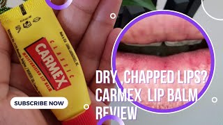 Carmex Moisturizing Lip Balm Review For Dry ,Chapped & Pink Lipsskincarr Review Uk
