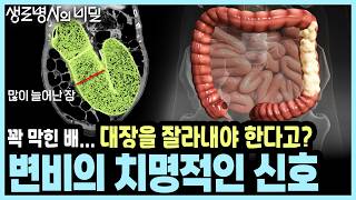 Download lagu [Broadcast Roundup] Can you die from fecal toxins? It's true! From pseudo-intestinal obstruction ...