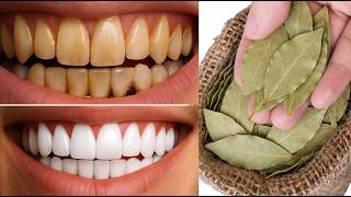 Dentists hide secrets! 🔥 Whitens teeth and removes tartar in 1 minute. screenshot 1