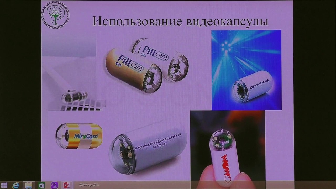 21 Щербаков ПЛ Капсульная эндоскопия в диагностике анемий и кровотечений неясного генеза