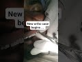#dentist #smiledesigndental #foreigntraineddentist k @thelookorthodontists