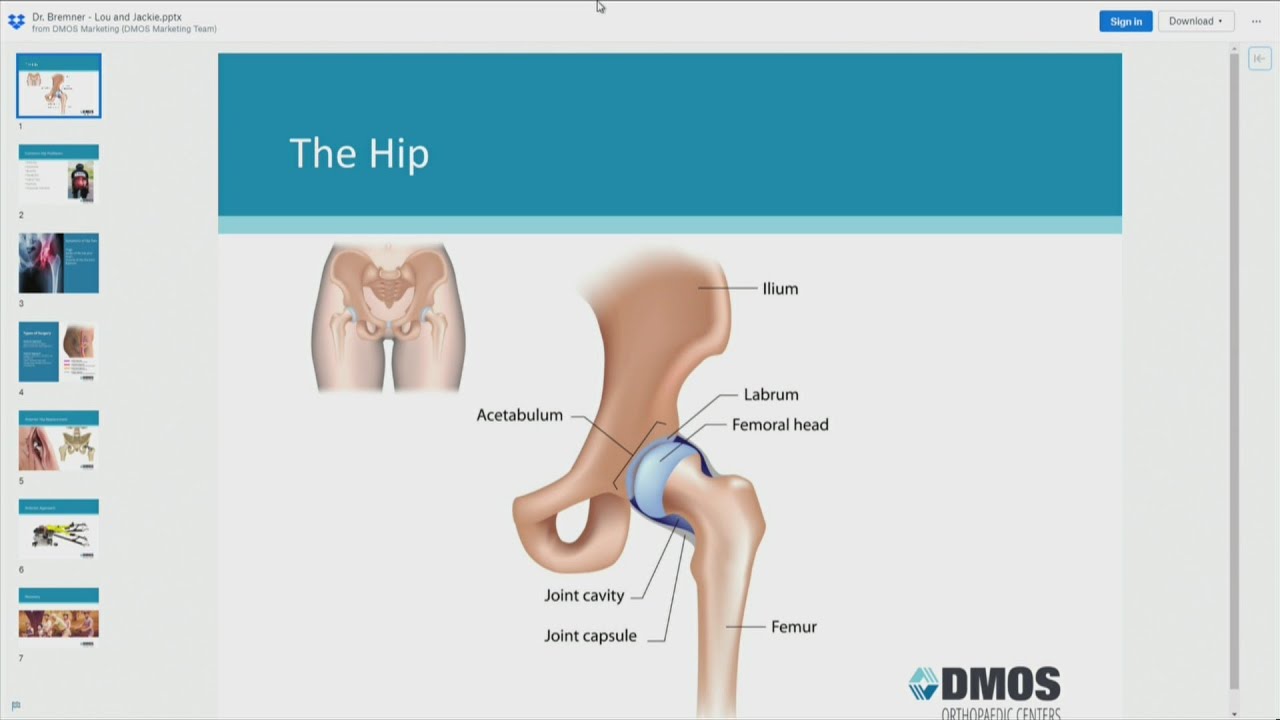 The Orthopedic Minute DMOS YouTube