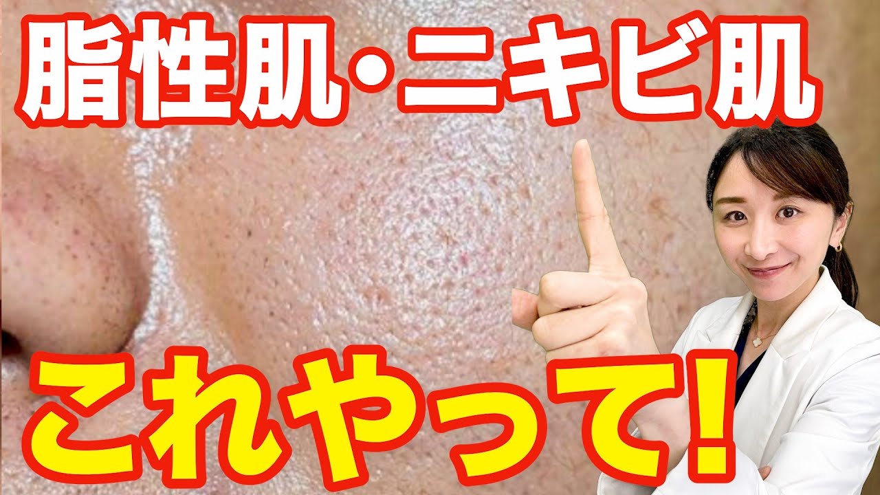【これさえ見ればすべて分かる】脂性肌・ニキビ肌の正しいケア方法を解説