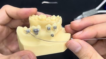 Video này dành cho bác sĩ nha khoa: Dựng trục răng 7