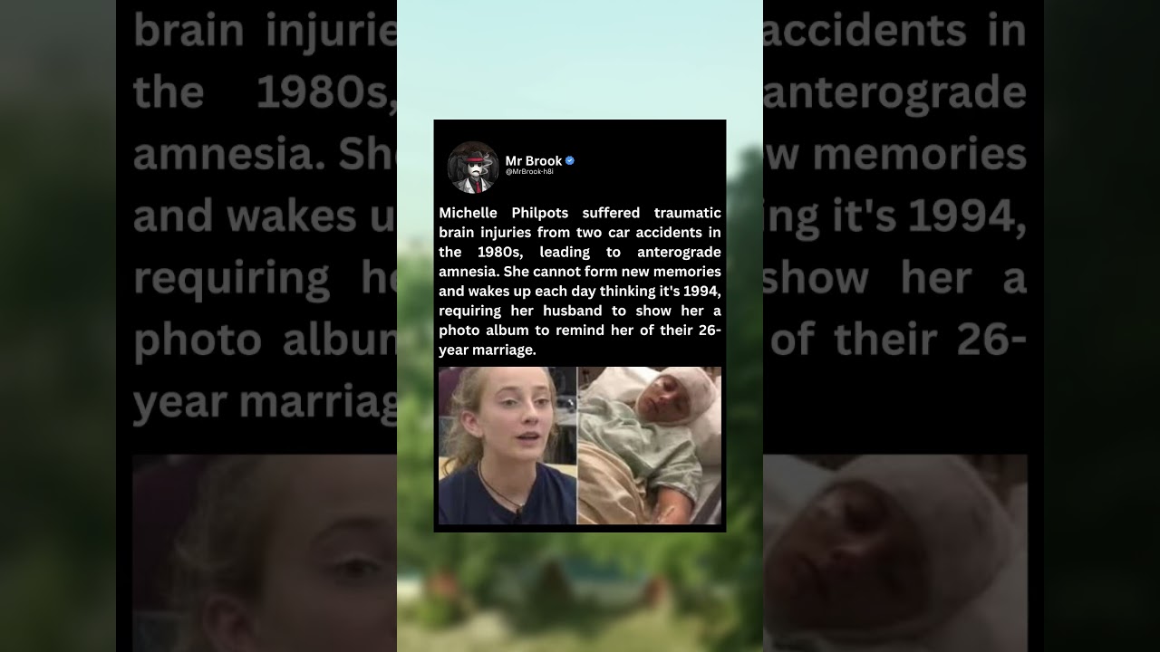 Michelle Philpots suffered traumatic brain injuries from two car accidents in the1980s
