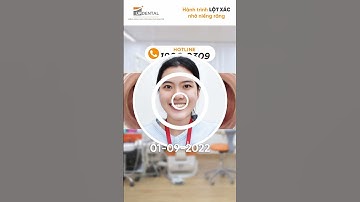 Hành trình LỘT XÁC nhờ niềng răng của khách hàng Minh Thư