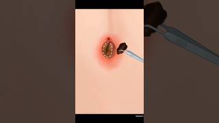 😳✨ASMR Belly Button Cleaning |  #asmr #animation #satisfying #tiktok #shorts