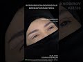 2026. Operatsiya 23🔥✨️ #nodirbakhodirov #blefaroplastika #operatsiya