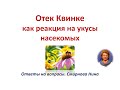 Отек Квинке как реакция на укусы насекомых (запись в Инстаграме)