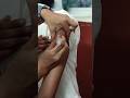 Day 10 How to give intramuscular injection administration 💉 #clinic #hospital
