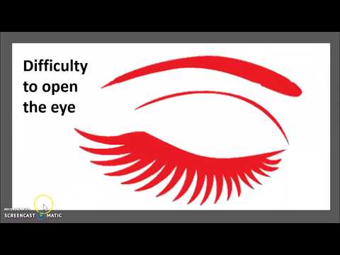 Preseptal vs Orbital Cellulitis: Red Flags & Emergency Treatment | Medicine in 3 Minutes