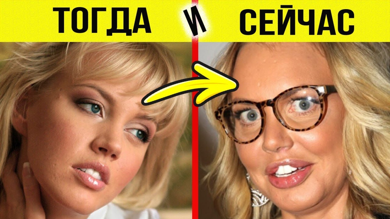 КУДА ИСЧЕЗЛА КРАСОТА? Этих певиц хотел каждый мужчина