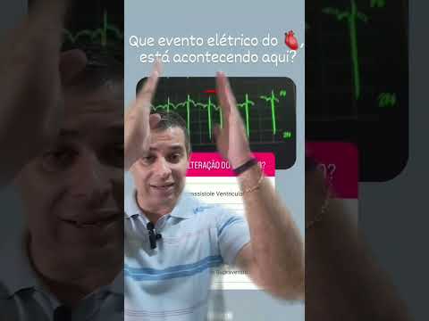 A Extrassístole Supraventricular