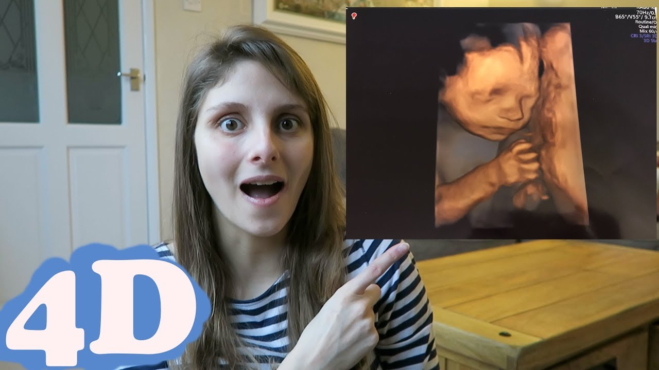 Window to the womb 4d scan reviews - baby boy - YouTube