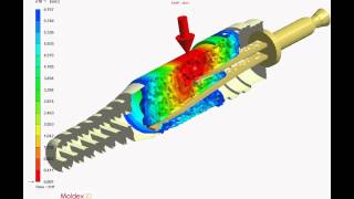 Moldex3D FSI (Fluid Structure Interaction)